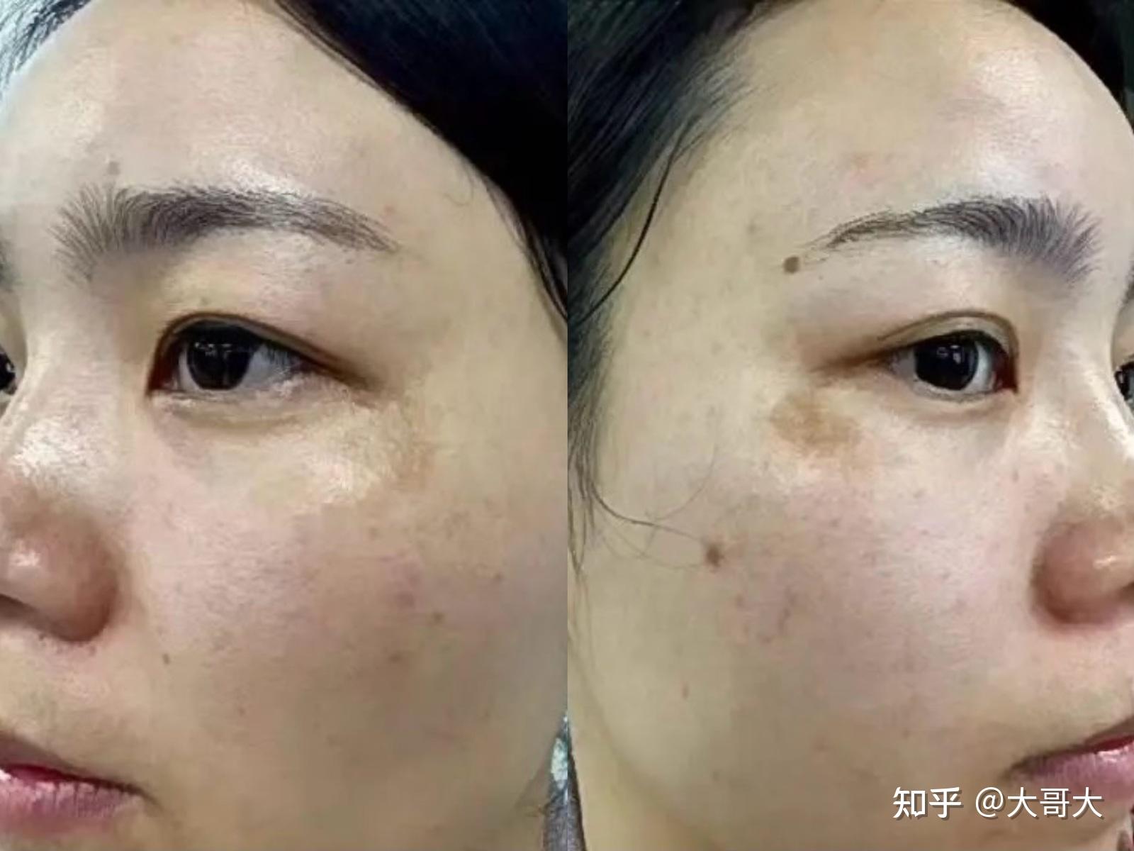 最新捕捉斑现象，多维视角深度解析